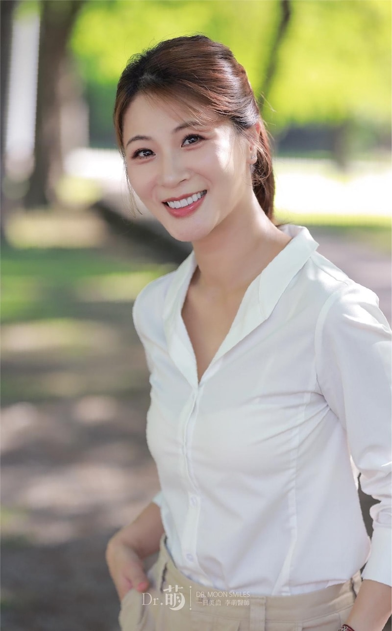 陶瓷貼片完成後笑容,牙齒明亮對稱,散發自然自信感
